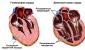 Hogyan történik a szív ultrahangja, és mit mutatnak a diagnosztikai eredmények?