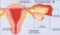 Mik a méhen kívüli terhesség tünetei és miért veszélyes?