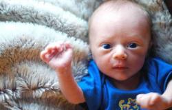 A kötőhártya-gyulladás tünetei és kezelése csecsemőknél