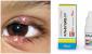 Ako liečiť štipľavé oko na detskom oku