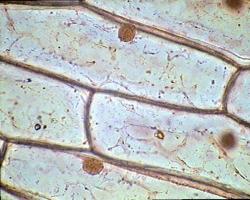 Differences between prokaryotes and eukaryotes Division of organisms into prokaryotes and eukaryotes