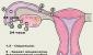 Τι είναι η ωορρηξία στις γυναίκες;