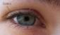 Mi a szem scleritis A szem sclera gyulladása kezelés