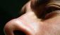 Az orr és a paranasalis sinus anatómiájának klinikai jellemzői