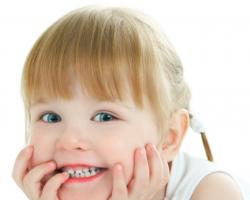 A kalcium hiánya vagy hiánya gyermekben: tünetek, kezelés