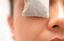 Πώς να θεραπεύσετε το στύλ στο άνω βλέφαρο: φάρμακα και λαϊκές θεραπείες