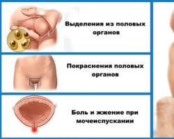 Příznaky a příznaky chlamydií u žen a mužů