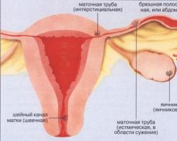 Koji su simptomi vanmaterične trudnoće i zašto je opasna?