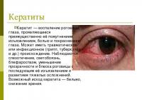 Θεραπεία μάτι δείχνουν με λαϊκές θεραπείες