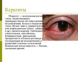 Eye show treatment with folk remedies
